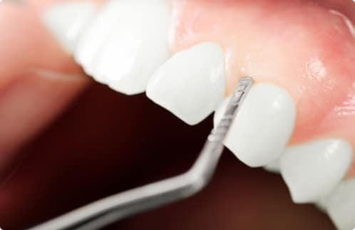 Zahnarzt Bochum - Dentalpraxis Philipp