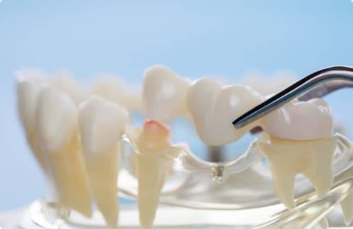 Zahnarzt Bochum - Dr. Philipp 26